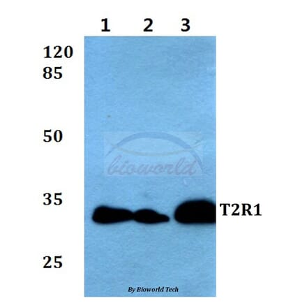 Anti-T2R1 (D45) Antibody from Bioworld Technology (BS2964) - Antibodies.com