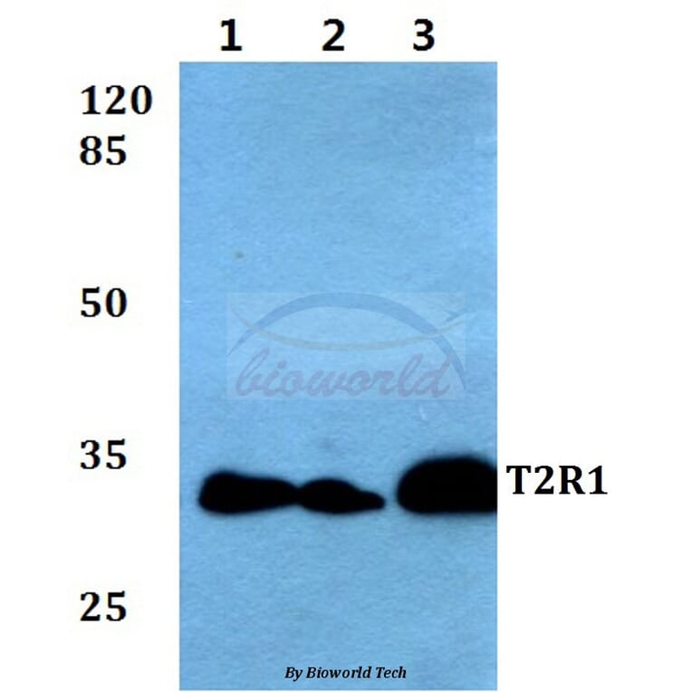 Anti-T2R1 (D45) Antibody from Bioworld Technology (BS2964) - Antibodies.com