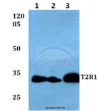 Anti-T2R1 (D45) Antibody from Bioworld Technology (BS2964) - Antibodies.com