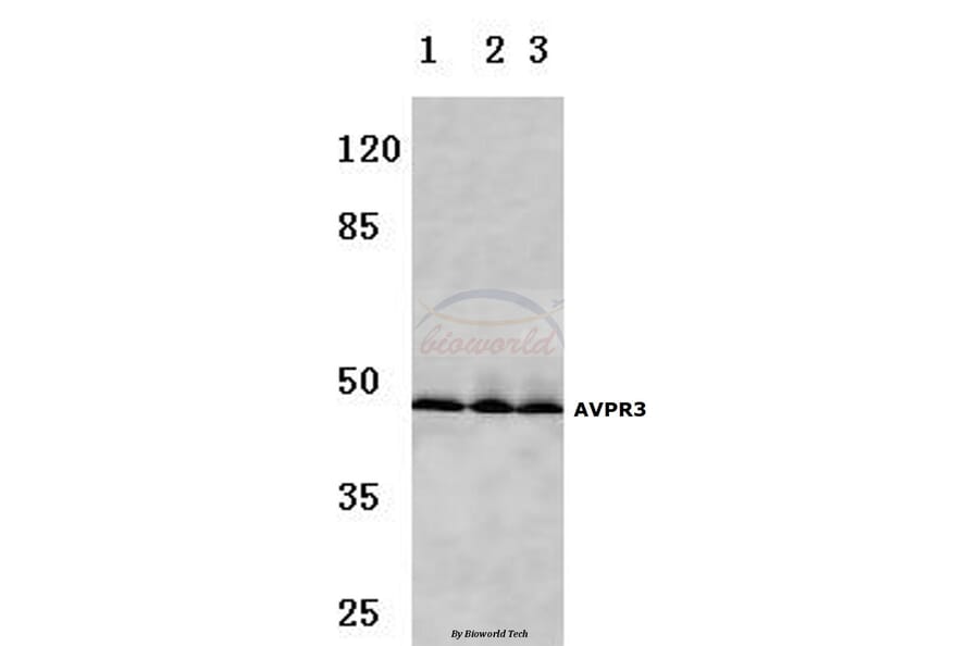 Anti-AVP Receptor V3 (D314) Antibody from Bioworld Technology (BS2968) - Antibodies.com