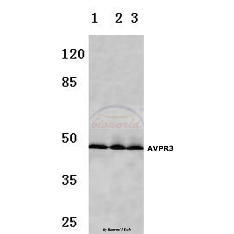 Anti-AVP Receptor V3 (D314) Antibody from Bioworld Technology (BS2968) - Antibodies.com