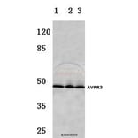 Anti-AVP Receptor V3 (D314) Antibody from Bioworld Technology (BS2968) - Antibodies.com