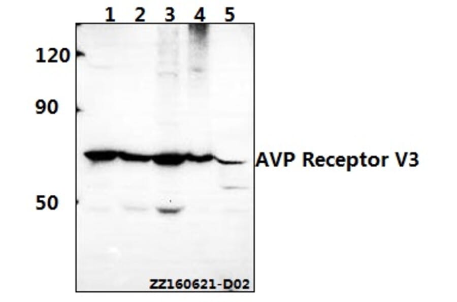 Anti-AVP Receptor V3 (D314) Antibody from Bioworld Technology (BS2968) - Antibodies.com
