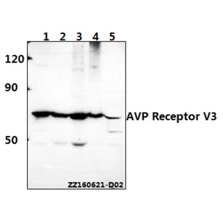 Anti-AVP Receptor V3 (D314) Antibody from Bioworld Technology (BS2968) - Antibodies.com