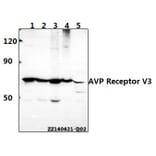 Anti-AVP Receptor V3 (D314) Antibody from Bioworld Technology (BS2968) - Antibodies.com