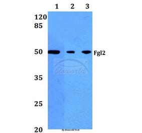 Anti-Fgl2 (V38) Antibody from Bioworld Technology (BS2972) - Antibodies.com