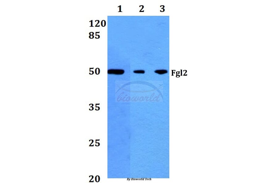Anti-Fgl2 (V38) Antibody from Bioworld Technology (BS2972) - Antibodies.com