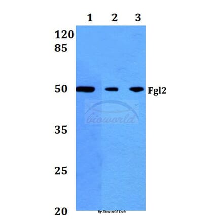 Anti-Fgl2 (V38) Antibody from Bioworld Technology (BS2972) - Antibodies.com