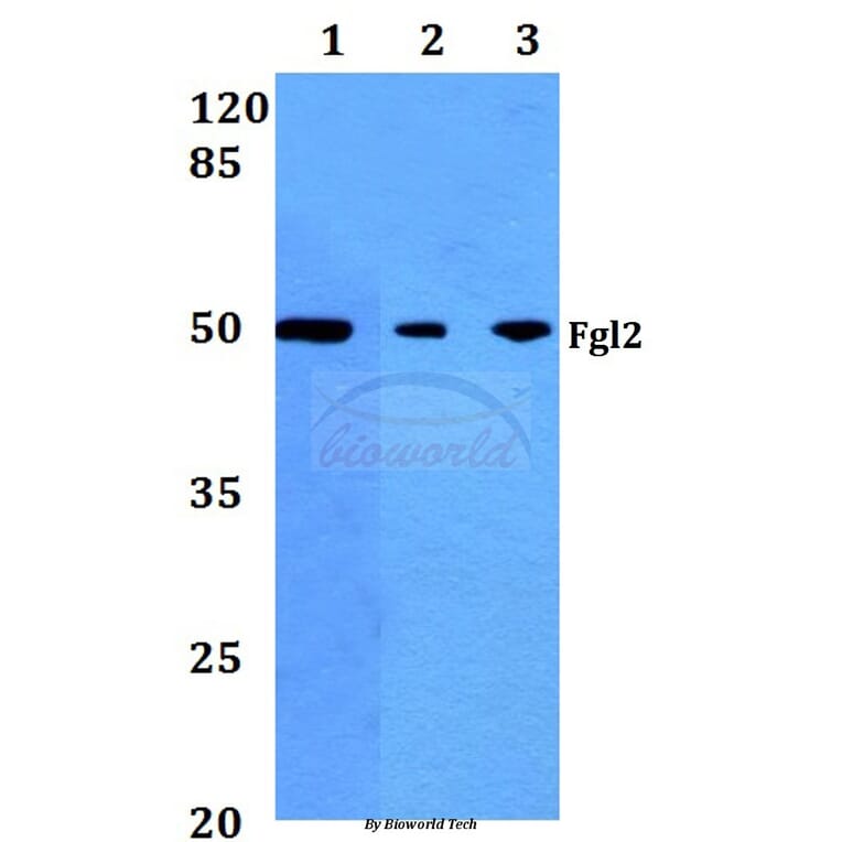 Anti-Fgl2 (V38) Antibody from Bioworld Technology (BS2972) - Antibodies.com