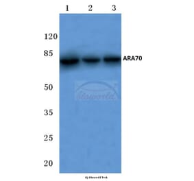 Anti-ARA70 (L379) Antibody from Bioworld Technology (BS2976) - Antibodies.com