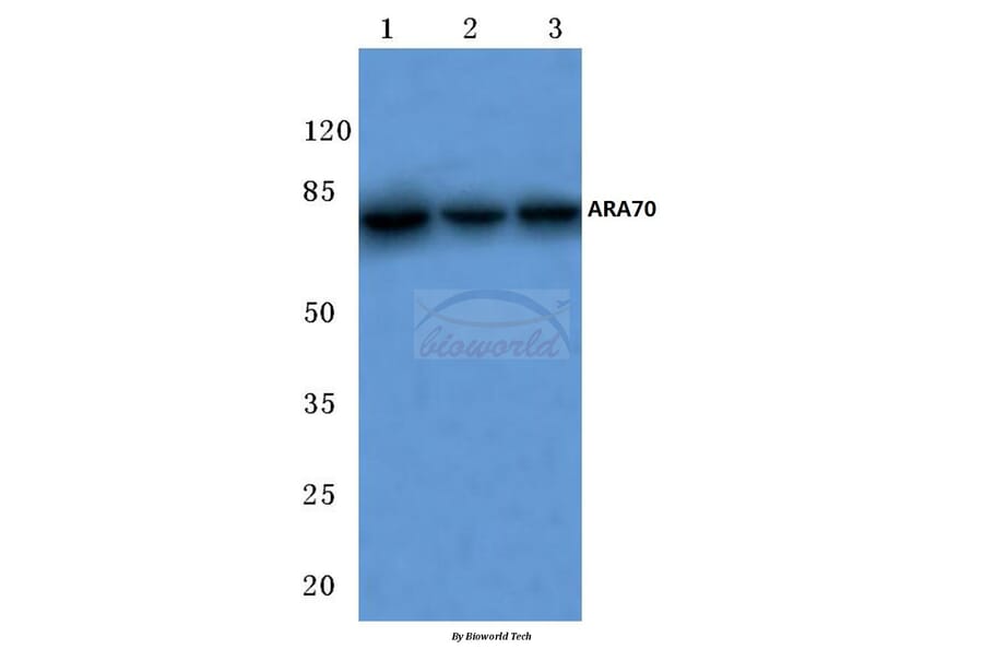 Anti-ARA70 (L379) Antibody from Bioworld Technology (BS2976) - Antibodies.com