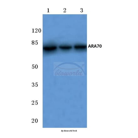 Anti-ARA70 (L379) Antibody from Bioworld Technology (BS2976) - Antibodies.com