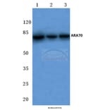 Anti-ARA70 (L379) Antibody from Bioworld Technology (BS2976) - Antibodies.com