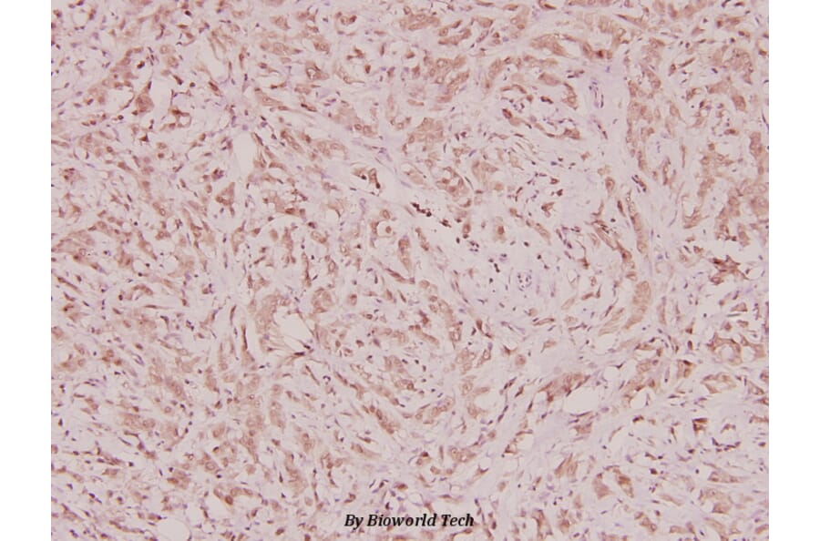 Anti-ARA70 (L379) Antibody from Bioworld Technology (BS2976) - Antibodies.com