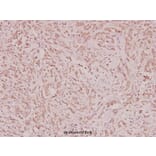 Anti-ARA70 (L379) Antibody from Bioworld Technology (BS2976) - Antibodies.com