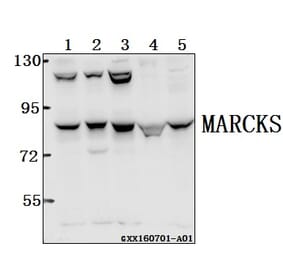 Anti-MARCKS (K152) Antibody from Bioworld Technology (BS2982) - Antibodies.com