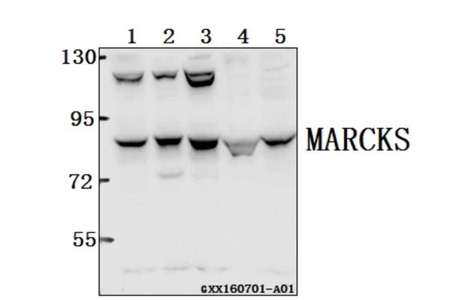 Anti-MARCKS (K152) Antibody from Bioworld Technology (BS2982) - Antibodies.com
