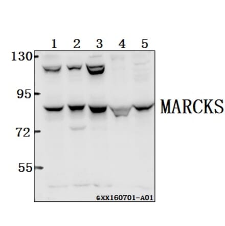 Anti-MARCKS (K152) Antibody from Bioworld Technology (BS2982) - Antibodies.com
