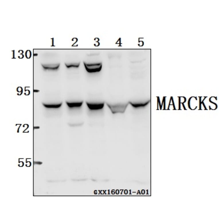 Anti-MARCKS (K152) Antibody from Bioworld Technology (BS2982) - Antibodies.com