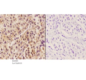 Anti-HNF4α (K307) Antibody from Bioworld Technology (BS2983) - Antibodies.com