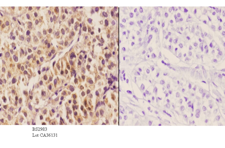 Anti-HNF4α (K307) Antibody from Bioworld Technology (BS2983) - Antibodies.com