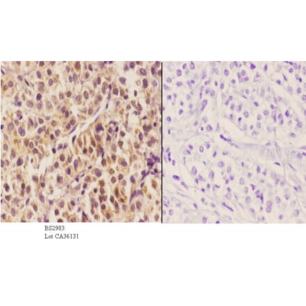 Anti-HNF4α (K307) Antibody from Bioworld Technology (BS2983) - Antibodies.com