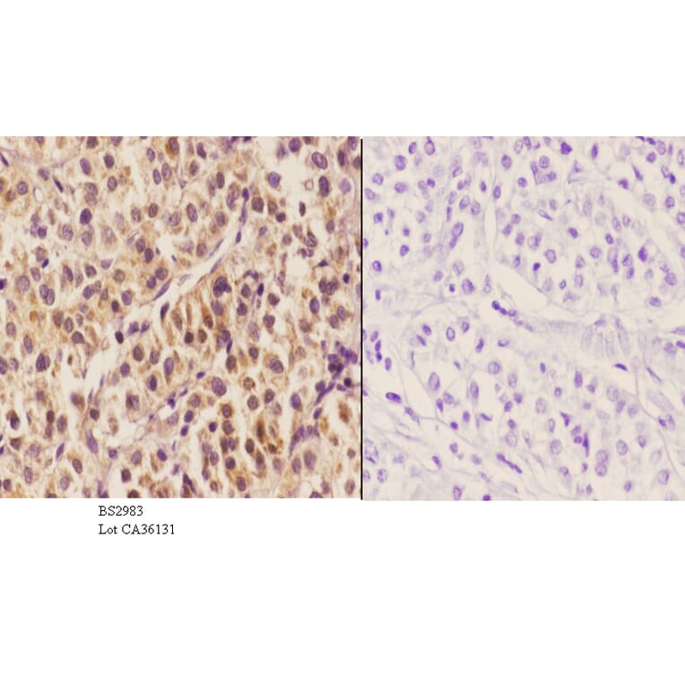 Anti-HNF4α (K307) Antibody from Bioworld Technology (BS2983) - Antibodies.com