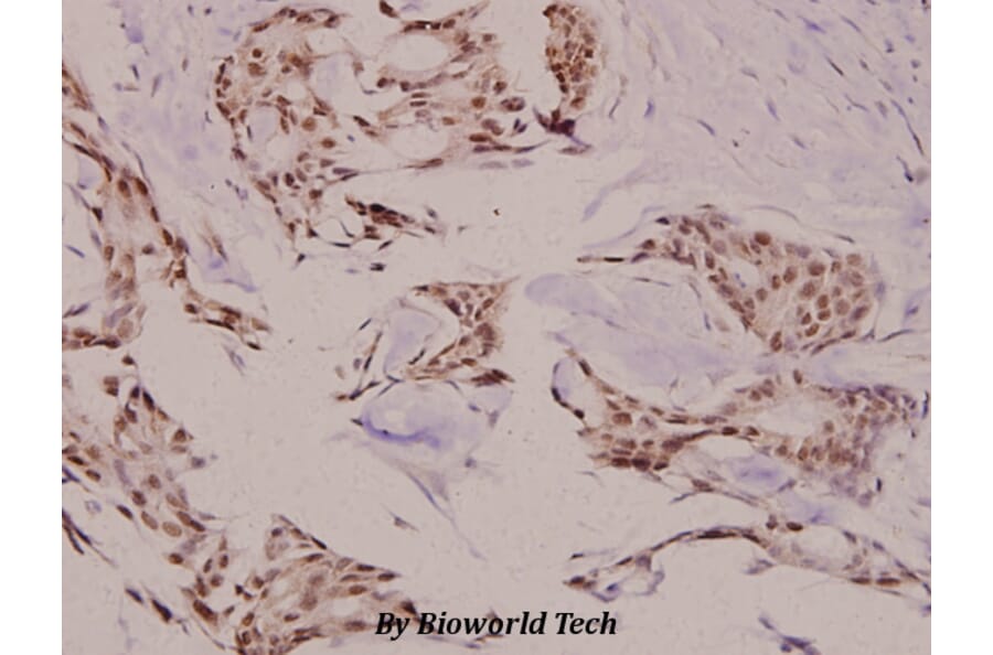 Anti-TEBP (K107) Antibody from Bioworld Technology (BS2986) - Antibodies.com