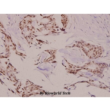Anti-TEBP (K107) Antibody from Bioworld Technology (BS2986) - Antibodies.com
