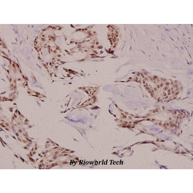 Anti-TEBP (K107) Antibody from Bioworld Technology (BS2986) - Antibodies.com