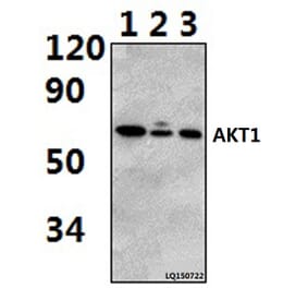 Anti-AKT1 (P125) Antibody from Bioworld Technology (BS2987) - Antibodies.com
