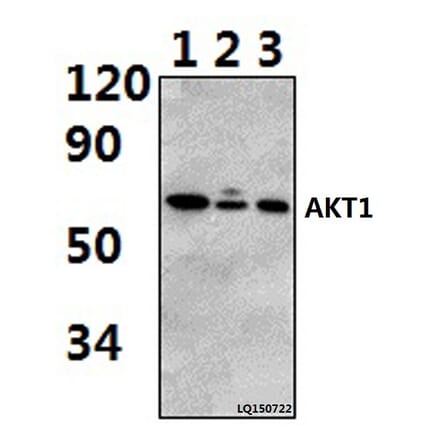Anti-AKT1 (P125) Antibody from Bioworld Technology (BS2987) - Antibodies.com