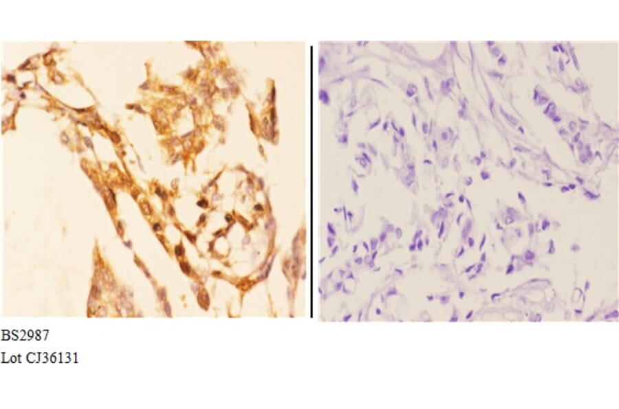 Anti-AKT1 (P125) Antibody from Bioworld Technology (BS2987) - Antibodies.com