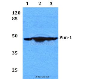 Anti-PIM1 (I302) Antibody from Bioworld Technology (BS2988) - Antibodies.com