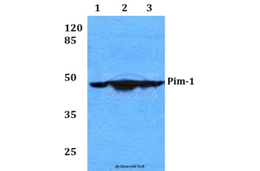 Anti-PIM1 (I302) Antibody from Bioworld Technology (BS2988) - Antibodies.com