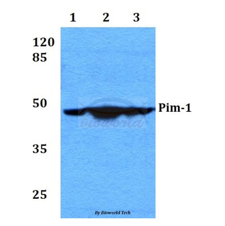 Anti-PIM1 (I302) Antibody from Bioworld Technology (BS2988) - Antibodies.com