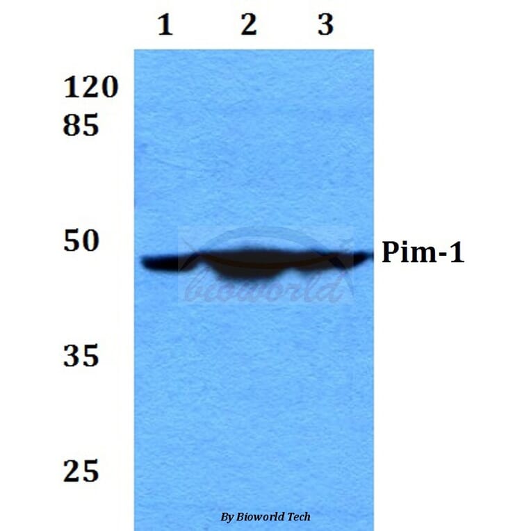 Anti-PIM1 (I302) Antibody from Bioworld Technology (BS2988) - Antibodies.com