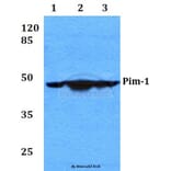 Anti-PIM1 (I302) Antibody from Bioworld Technology (BS2988) - Antibodies.com