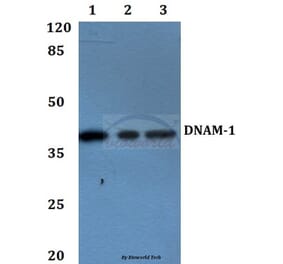Anti-DNAM-1 (Y325) Antibody from Bioworld Technology (BS2990) - Antibodies.com