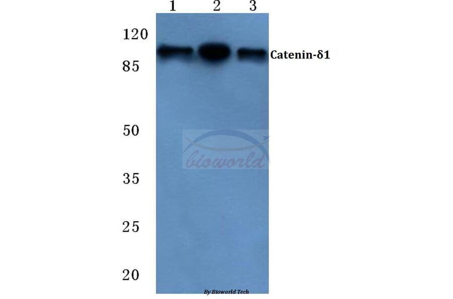Anti-Catenin-δ1 (G224) Antibody from Bioworld Technology (BS2992) - Antibodies.com