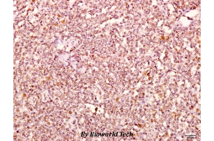 Anti-Catenin-δ1 (G224) Antibody from Bioworld Technology (BS2992) - Antibodies.com