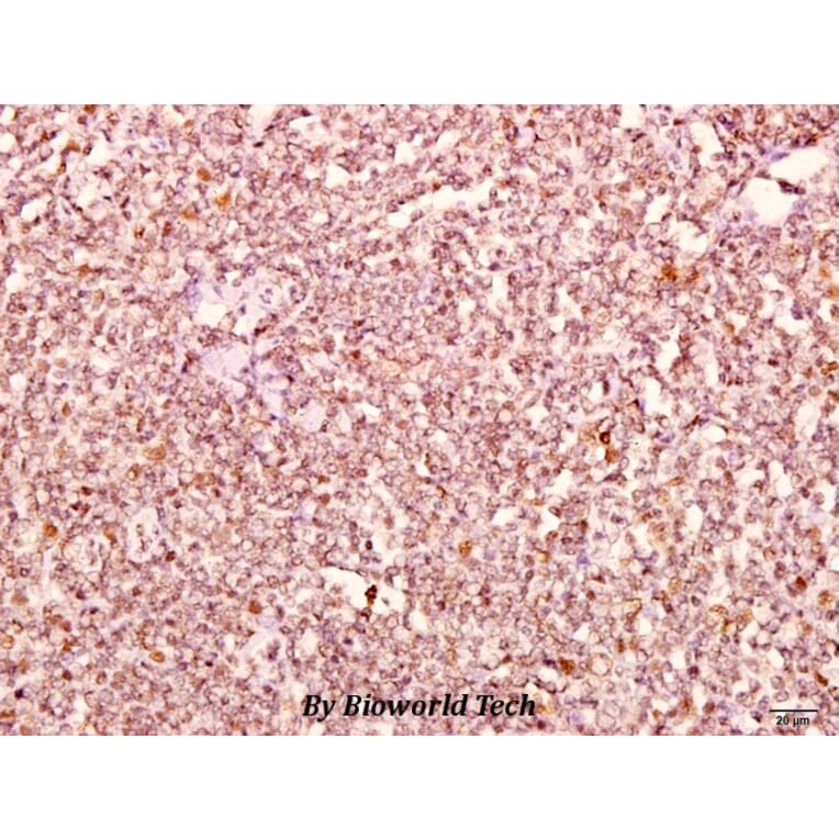 Anti-Catenin-δ1 (G224) Antibody from Bioworld Technology (BS2992) - Antibodies.com