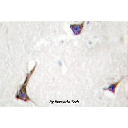 Anti-Syndecan-4 (K175) Antibody from Bioworld Technology (BS2994) - Antibodies.com