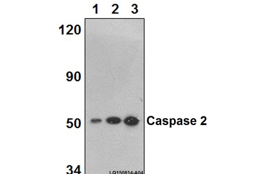 Anti-Caspase 2 (K152) Antibody from Bioworld Technology (BS2995) - Antibodies.com