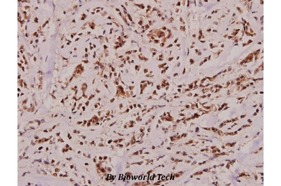Anti-Caspase 2 (K152) Antibody from Bioworld Technology (BS2995) - Antibodies.com
