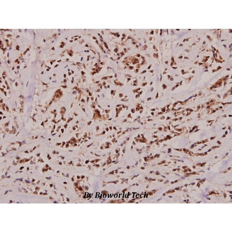 Anti-Caspase 2 (K152) Antibody from Bioworld Technology (BS2995) - Antibodies.com