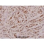 Anti-Caspase 2 (K152) Antibody from Bioworld Technology (BS2995) - Antibodies.com