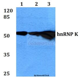 Anti-hnRNP K (Y280) Antibody from Bioworld Technology (BS2997) - Antibodies.com