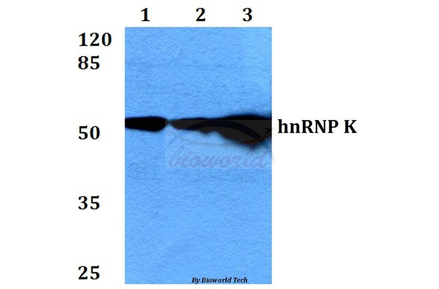 Anti-hnRNP K (Y280) Antibody from Bioworld Technology (BS2997) - Antibodies.com