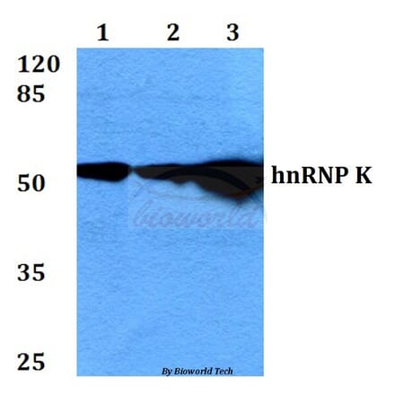 Anti-hnRNP K (Y280) Antibody from Bioworld Technology (BS2997) - Antibodies.com